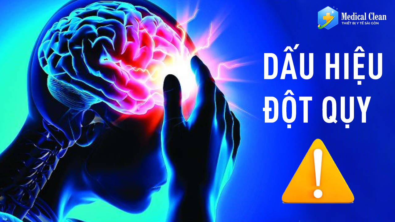 Dấu hiệu đột quỵ